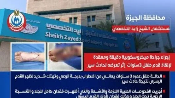 في الكورة : الصحة: إجراء جراحة ميكروسكوبية دقيقة لطفل 3 سنوات بمستشفى زايد التخصصى