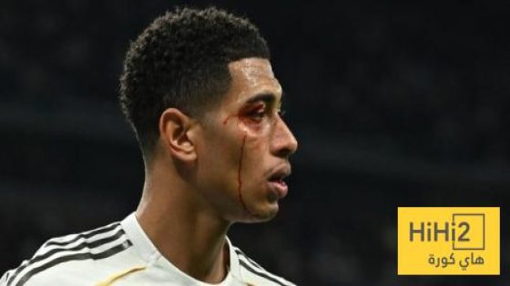 في الكورة : صورة مقربة لإصابة جود بيلينغهام